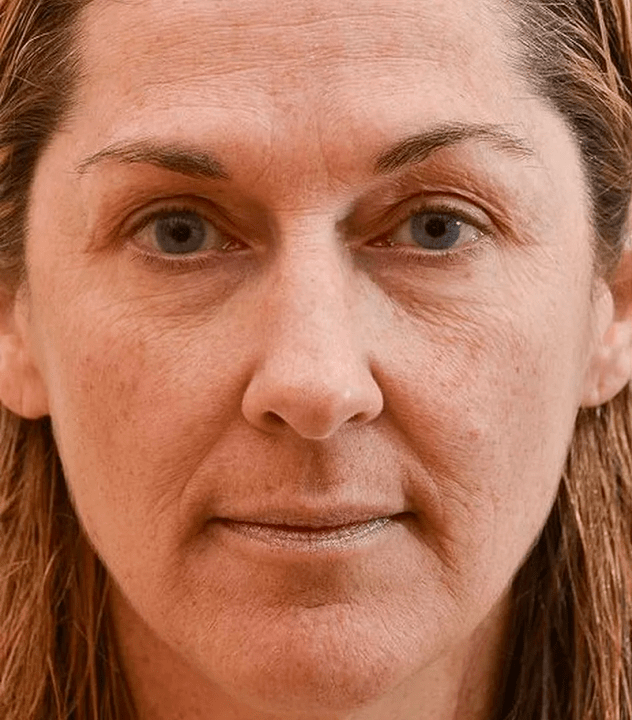 Az arcom az eudalie krém használata előtt